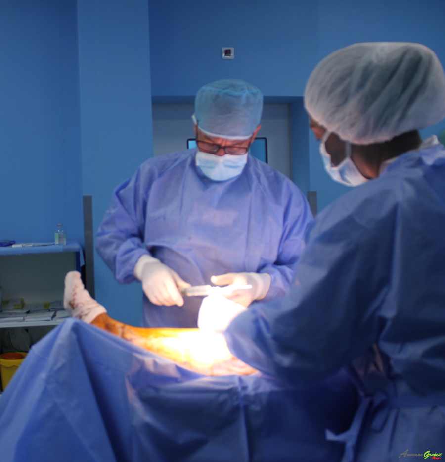 traitement des varices casablanca Maroc Dr LASRY